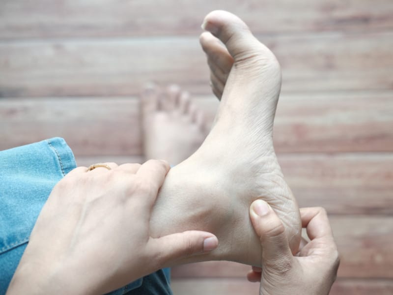 Plantar Fasciitis